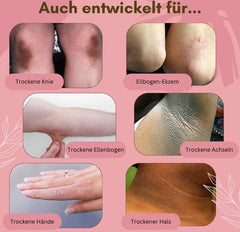 1+1 FREE | FungaRelief™ Arnica Cream — Heal, Nourish, and Protect Your Feet with One Cream