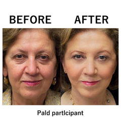 1+1 FREE | Instant Temporary Skin Tightener™ Reveal Smooth, Youthful Skin in Minutes