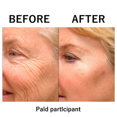 1+1 FREE | Instant Temporary Skin Tightener™ Reveal Smooth, Youthful Skin in Minutes