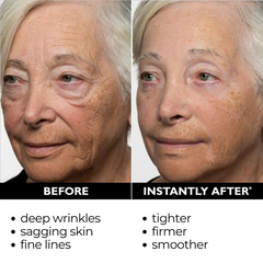 1+1 FREE | Instant Temporary Skin Tightener™ Reveal Smooth, Youthful Skin in Minutes