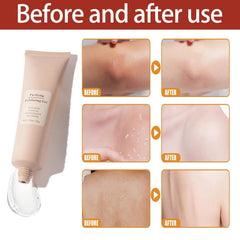 1+1 FREE| LunaRadiance™ Instantly Eliminate Dark Spots for a Flawless Complexion