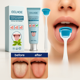 FreshSeal™ Probiotic Tongue Gel Set — Combat Hidden Bad Breath and Exude Confidence All Day