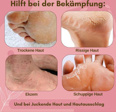 1+1 FREE | FungaRelief™ Arnica Cream — Heal, Nourish, and Protect Your Feet with One Cream