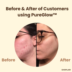 Black Tea Mask | Deep Pore Cleansing | Radiant Glow