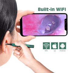 Otoscope sans fil Wifi 3,0 mm pour cure-oreille, caméra endoscopique, nettoyage lumineux du cérumen, inspection buccale, soins de santé, 3,0/5,0 MP