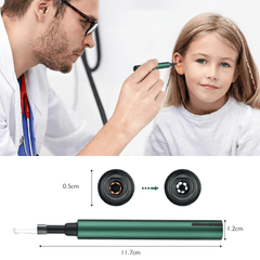 Otoscope sans fil Wifi 3,0 mm pour cure-oreille, caméra endoscopique, nettoyage lumineux du cérumen, inspection buccale, soins de santé, 3,0/5,0 MP