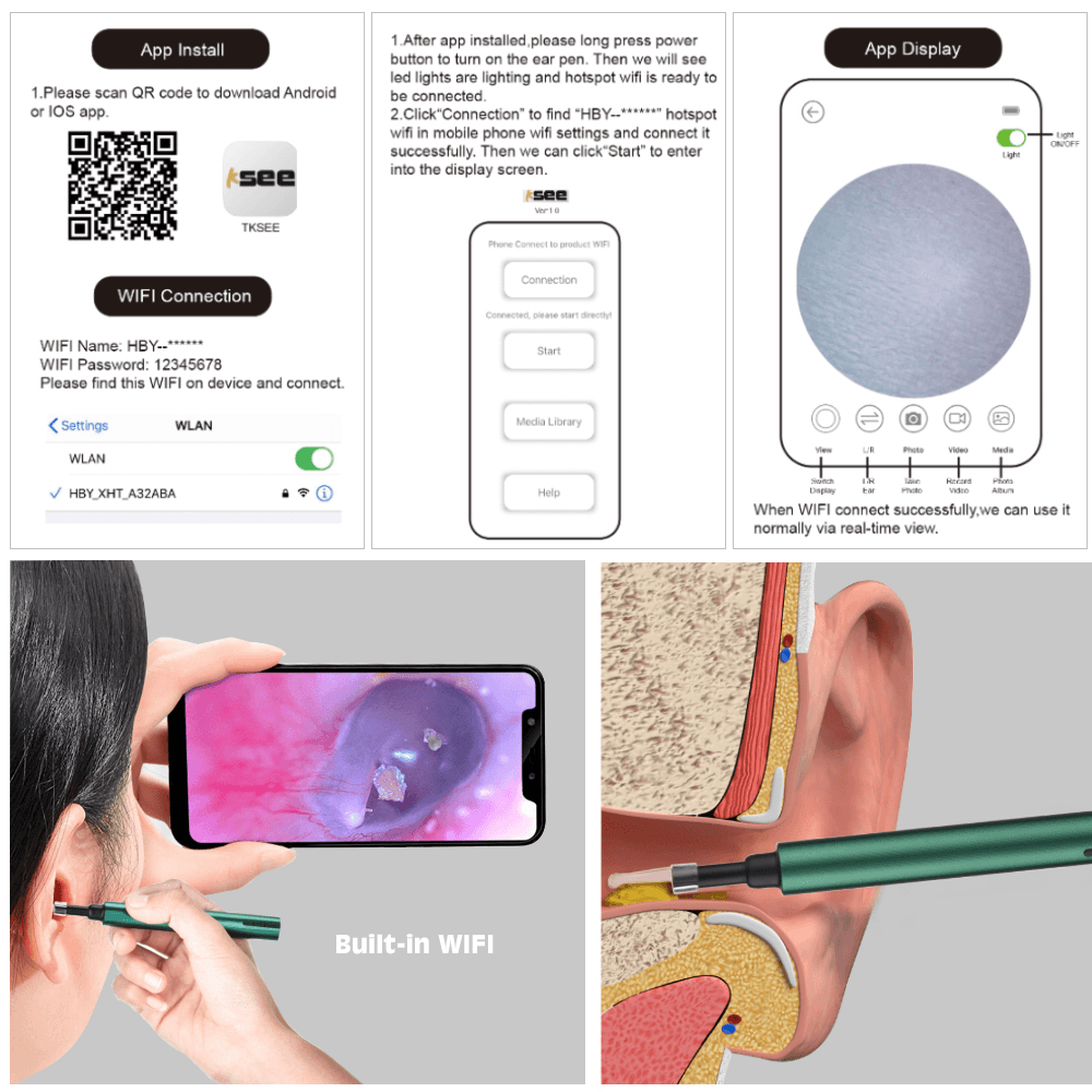 Otoscope sans fil Wifi 3,0 mm pour cure-oreille, caméra endoscopique, nettoyage lumineux du cérumen, inspection buccale, soins de santé, 3,0/5,0 MP