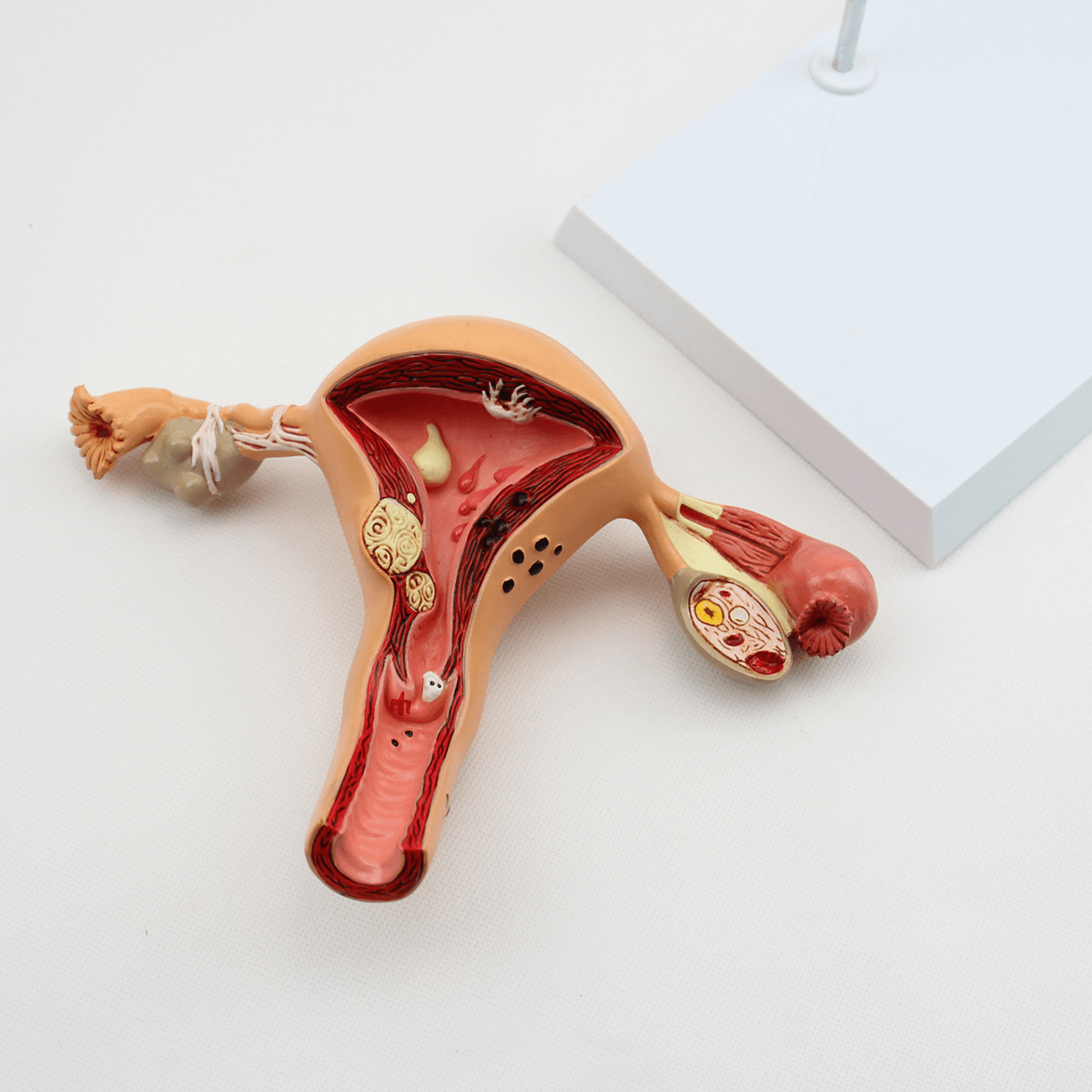 1 modelo médico anatómico de útero y ovario, anatomía de sección transversal, juguete científico con base