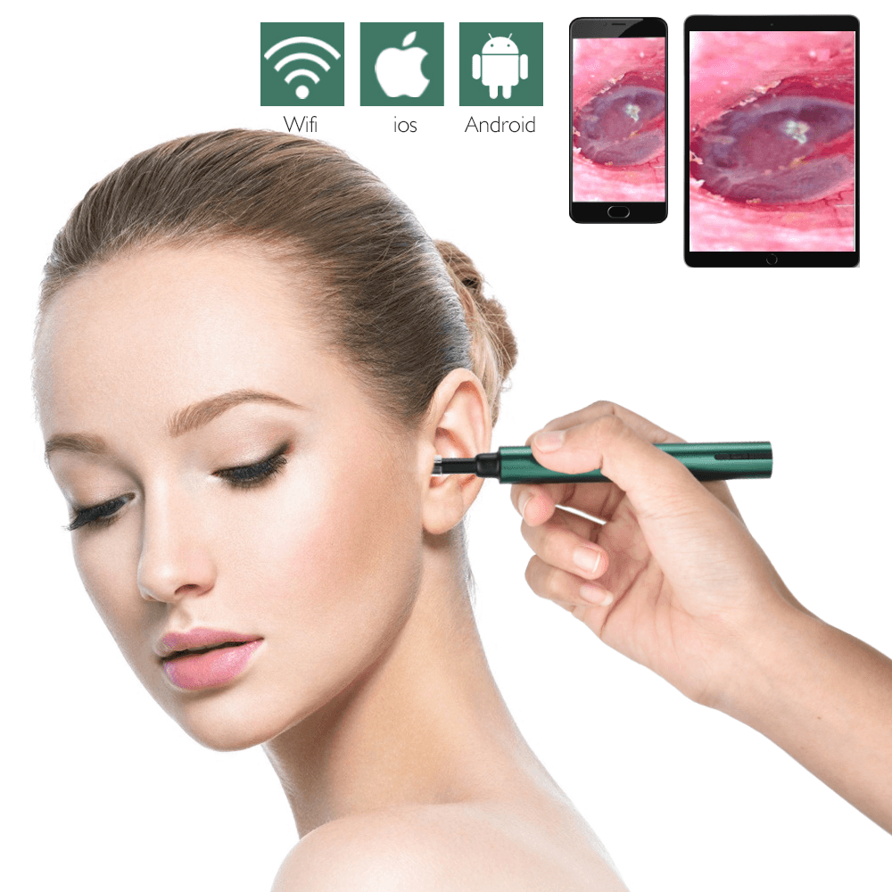 Otoscope sans fil Wifi 3,0 mm pour cure-oreille, caméra endoscopique, nettoyage lumineux du cérumen, inspection buccale, soins de santé, 3,0/5,0 MP