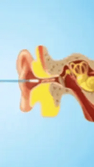 osgig™ - Intelligent Ear Cleaner with Camera