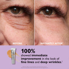 InstaLift Film | Flex-Tensor Technology for Instant Tightening