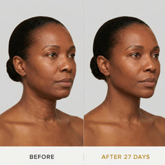 JAWLIFT Mask | Sculpting Jawline Enhancer, Skin-Friendly Fabric