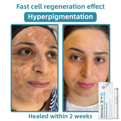 LumiDerm™ – Reveal Radiant, Flawless Skin and Achieve Quick Confidence