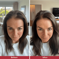 LuxoraBoost™ — Achieve lush, thick hair with minimal effort