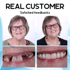 Natural-Looking Smile | Easy Home Dental Solution | Silicone Reline Denture Set