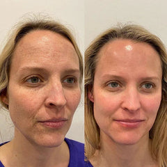 osgig™ Deep Cleanser — Lets you achieve professional-level skin care from the comfort of your home