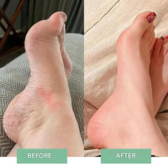 Revivax™ - The Innovative EMS Foot Massage For Instant Relief