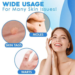 Skin Tag Removal Kit | Easy Band Application | At-Home Use | Fast Results |TagGone
